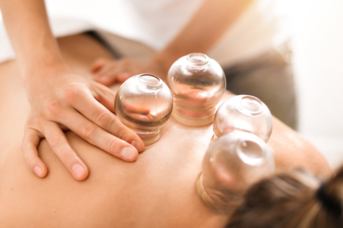Therapist hands performing cupping treatment on patient's back